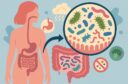 Disbioza intestinală