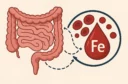 deficitul de fier